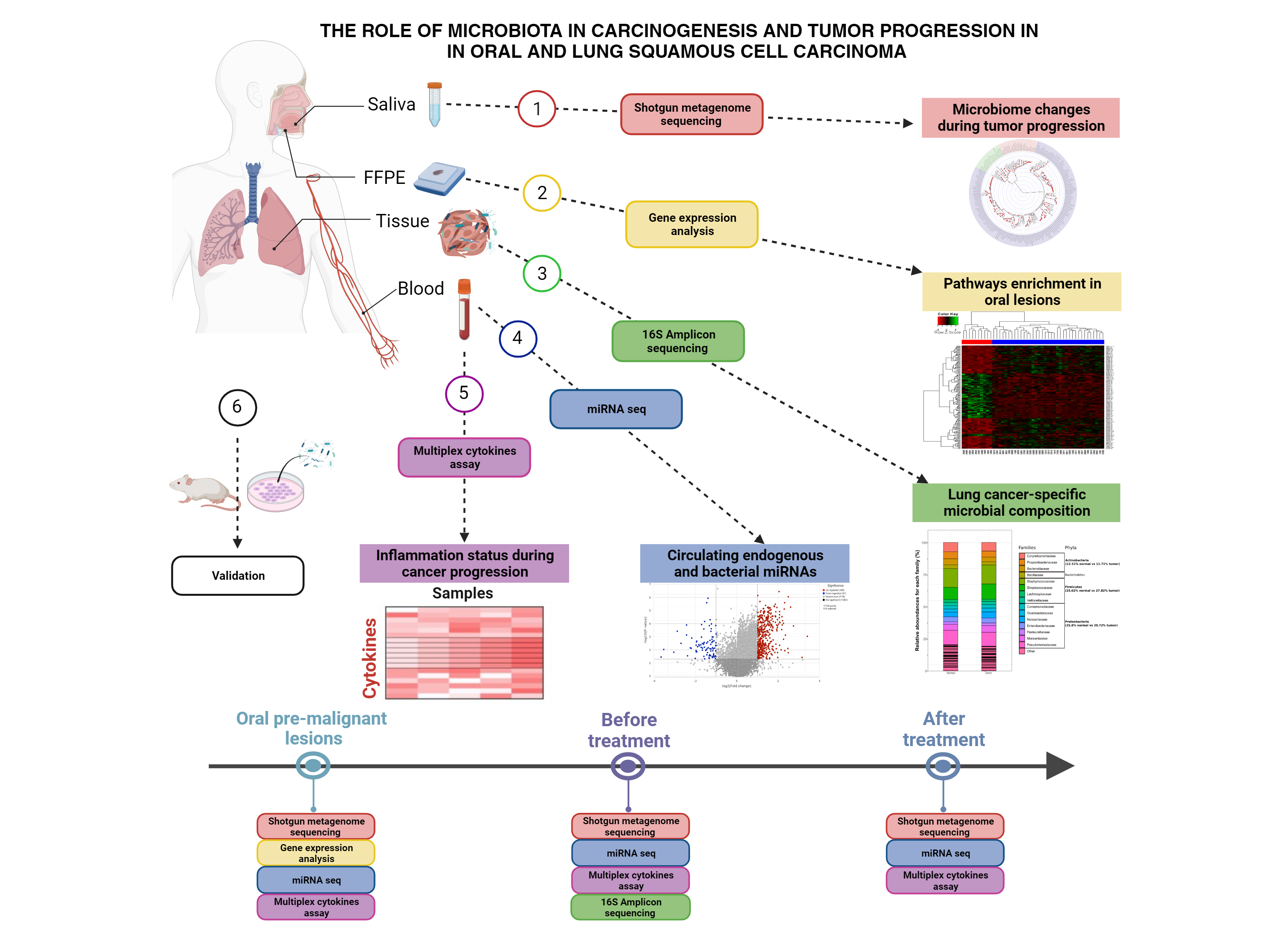 The role of microbiota in carcinogenesis and tumor progression in SSC